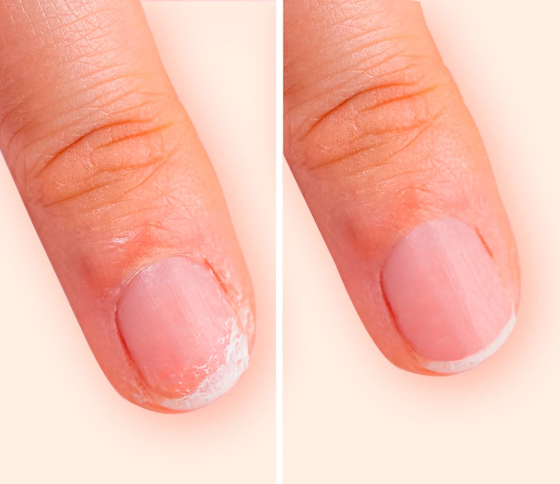 Keratin Booster Nail Serum fra Manucurist Paris – køb hos Butik Alrum